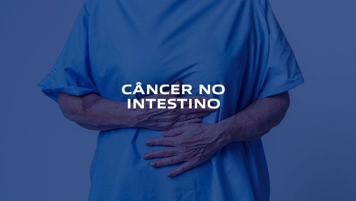 Câncer de intestino - Dr Paulo Kassab CRM 42.138