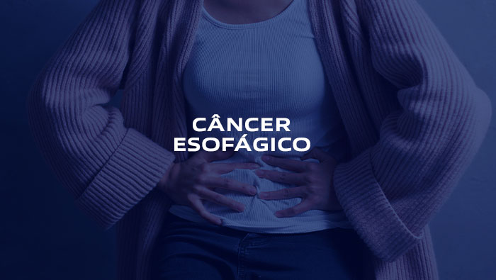 câncer esofagico - Dr Paulo Kassab CRM 42.138