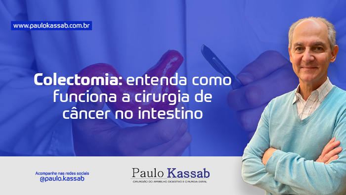colectomia entenda como funciona a cirurgia de cancer no intestino dr paulo kassab bg