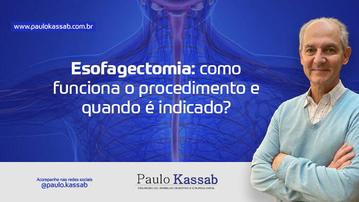 esofagectomia como funciona o procedimento e quando e indicado blog