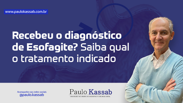 Imagem ilustra um esôfago, em desenho.