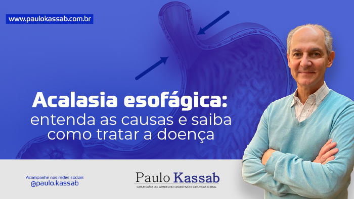 ACALASIA ESOFAGICA DR. KASSAB BLOG