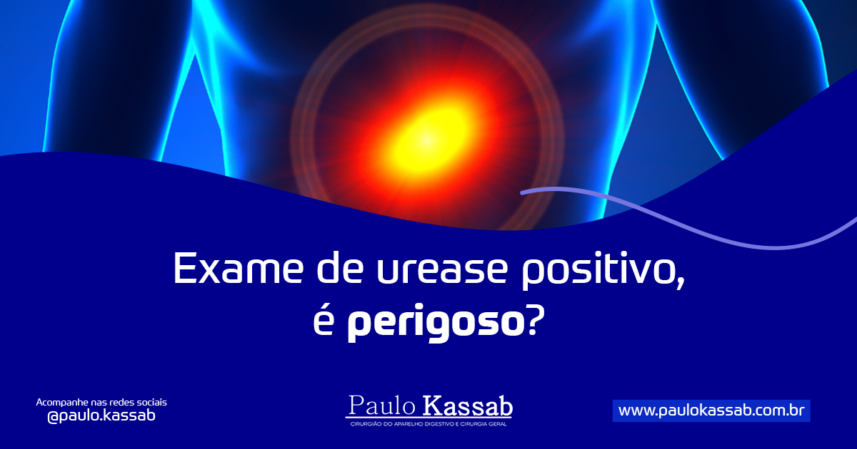 Exame de urease positivo, é perigoso? - Dr Paulo Kassab