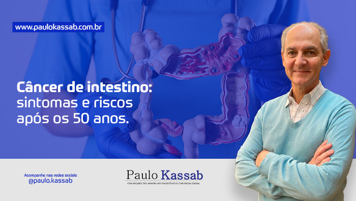 Câncer de intestino: sintomas e riscos após os 50 anos 1 Profissional da saúde segurando modelo anatômico do intestino humano com sinais de inflamação, indicando estudo ou prevenção de doenças intestinais.