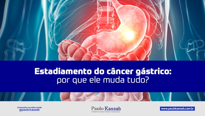 Estadiamento do câncer gástrico (ou câncer do estômago): por que ele muda tudo? 1 Ilustração anatômica do sistema digestivo com esôfago, estômago e intestinos visíveis, com uma área iluminada em destaque no estômago.