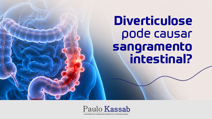 Arte sobre diverticulose e sangramento intestinal