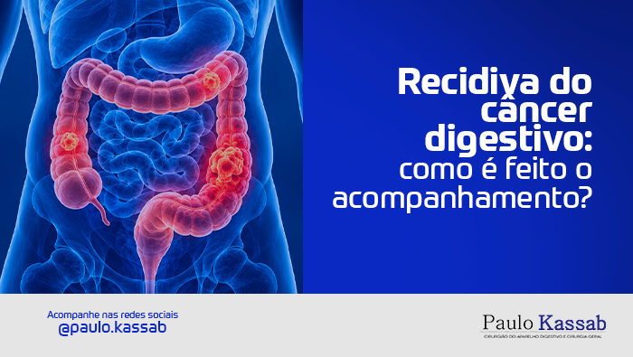 Recidiva do câncer digestivo: como é feito o acompanhamento? 1 Arte sobre recidiva do câncer digestivo